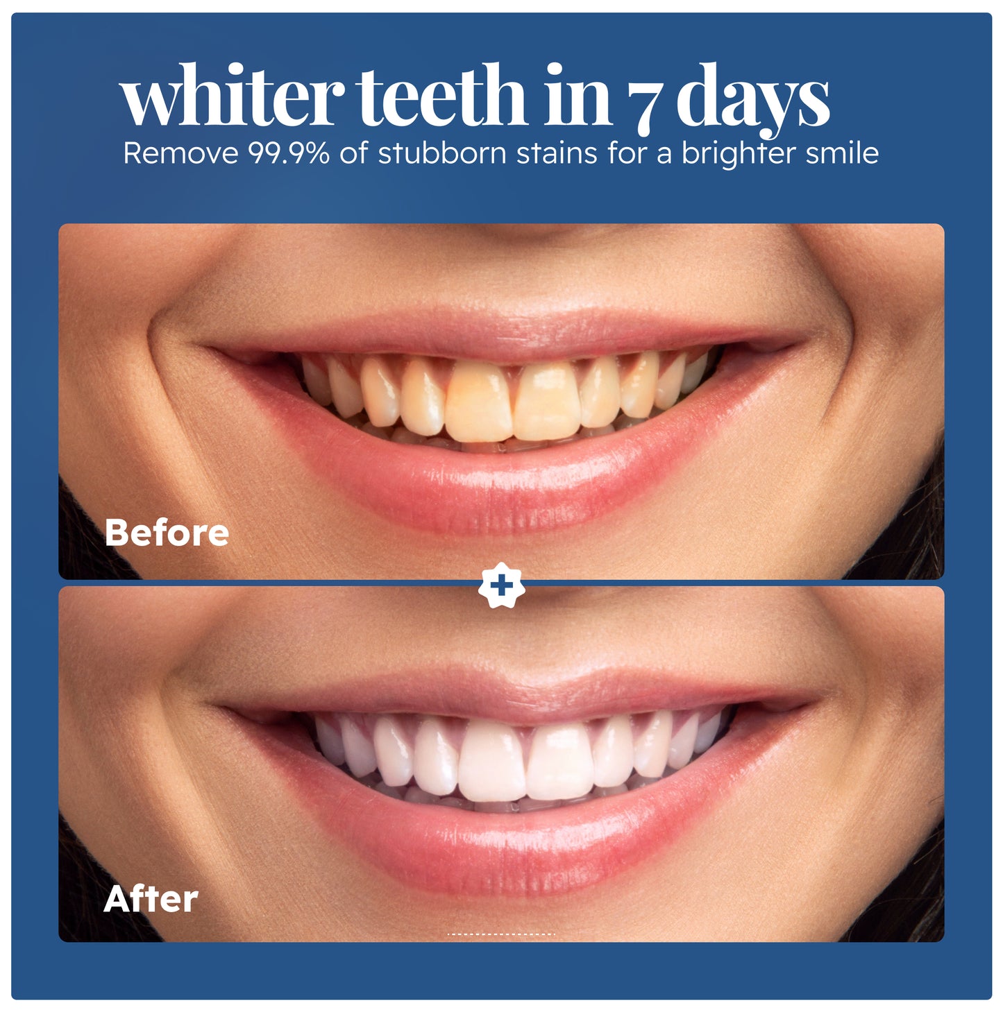 Teeth Whitening Powder
