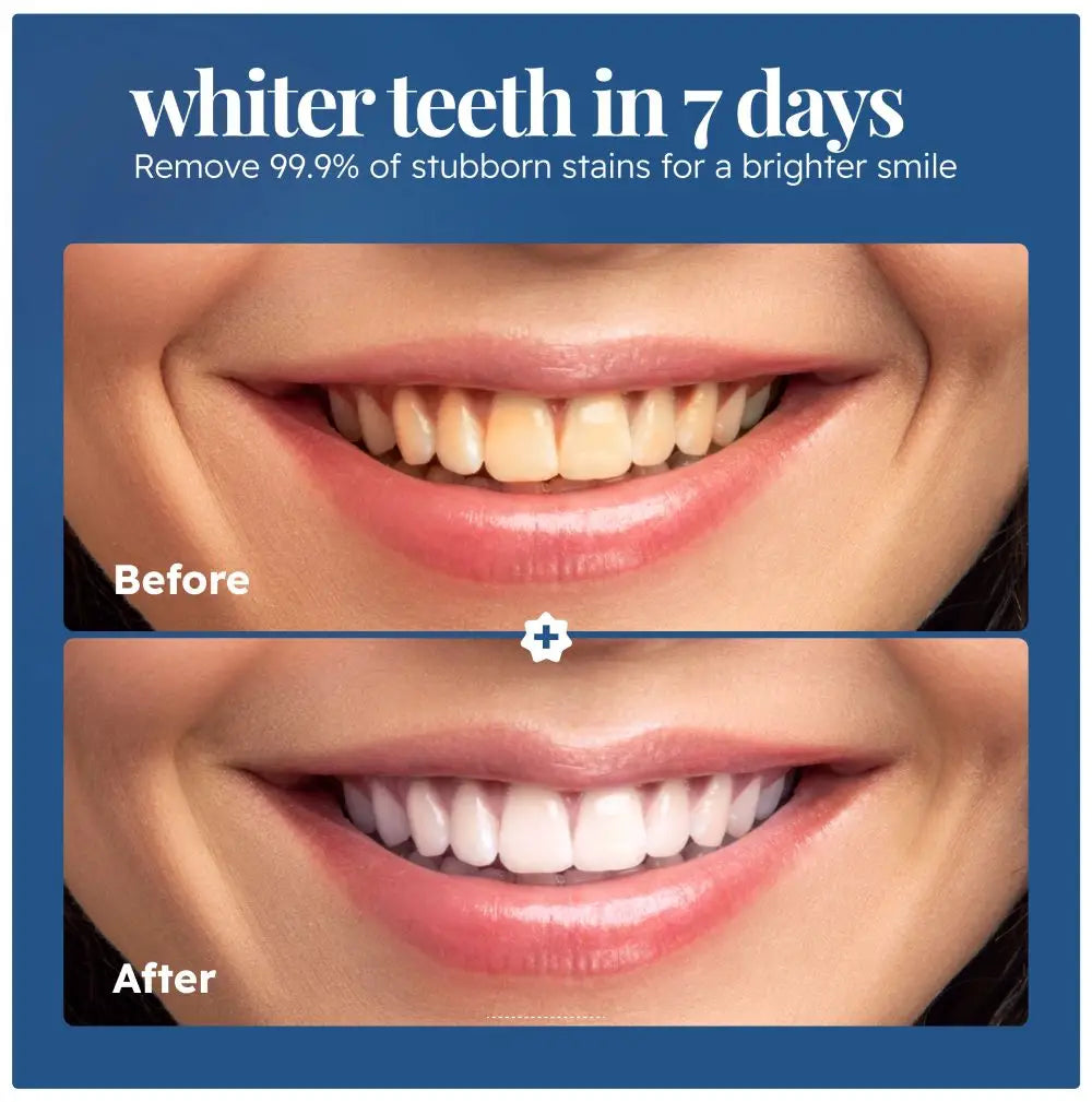 Before and after showing teeth whitening with ecobrightsmiles powder results with text 'whiter teeth in 7 days' on a blue background.
